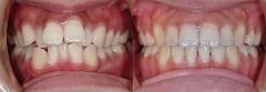orthodontic_img002